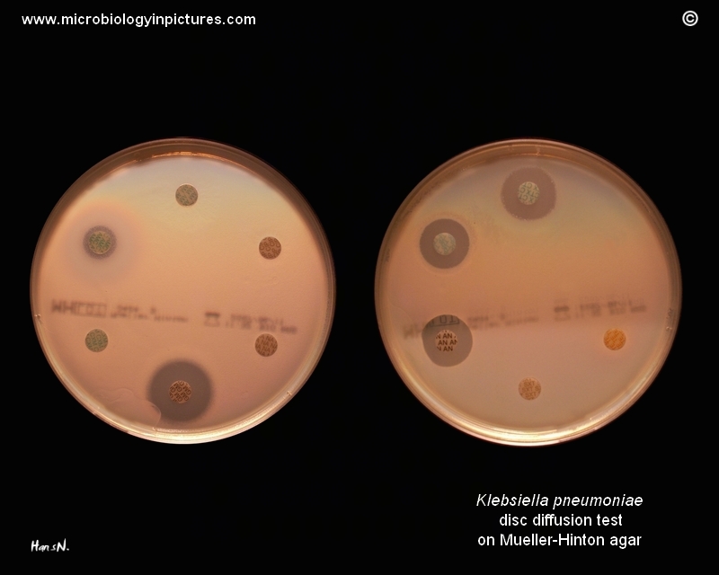 ESBL Producing Klebsiella Pneumoniae Disk Diffusion Test Klebsiella   Klebsiella Pneumoniae 034 